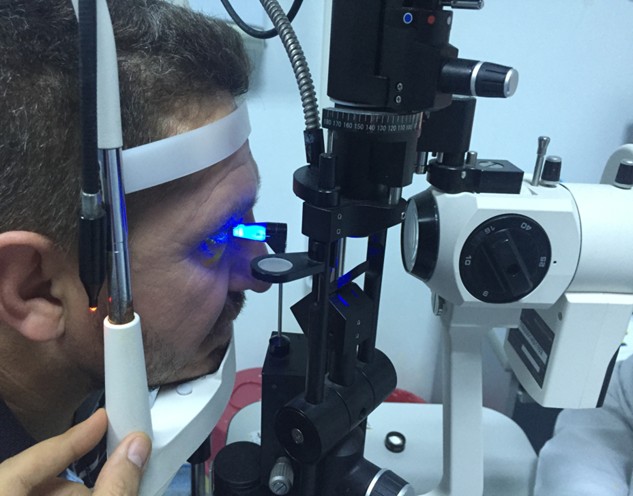 Göz tansiyonunda erken teşhis kalıcı körlüğü engelliyor